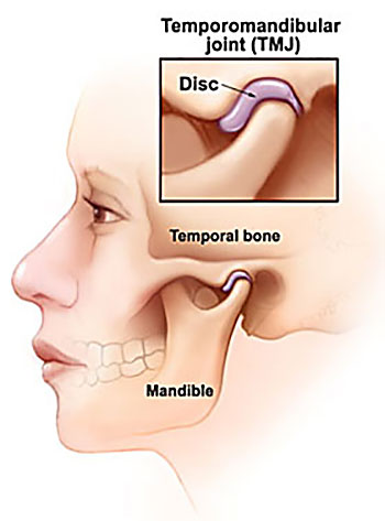 Toothwise Dental Clinic Muscle, Joint Pain